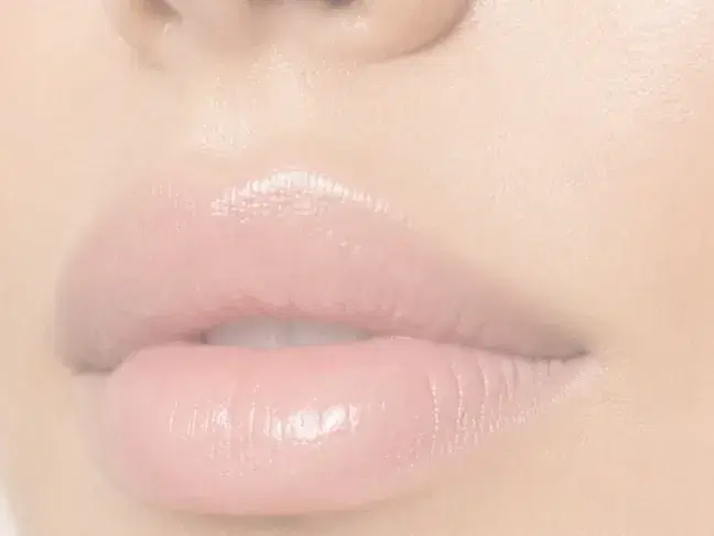 Aumento de labios