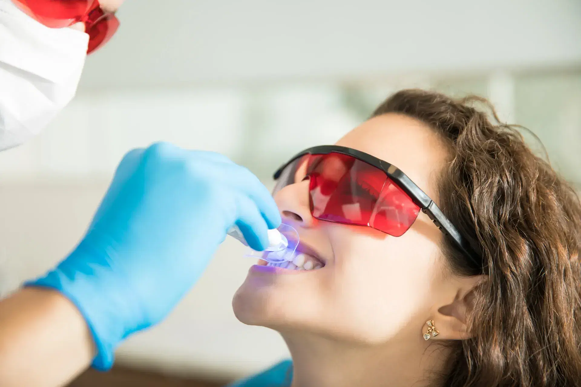 Blanqueamiento dental en Gavà