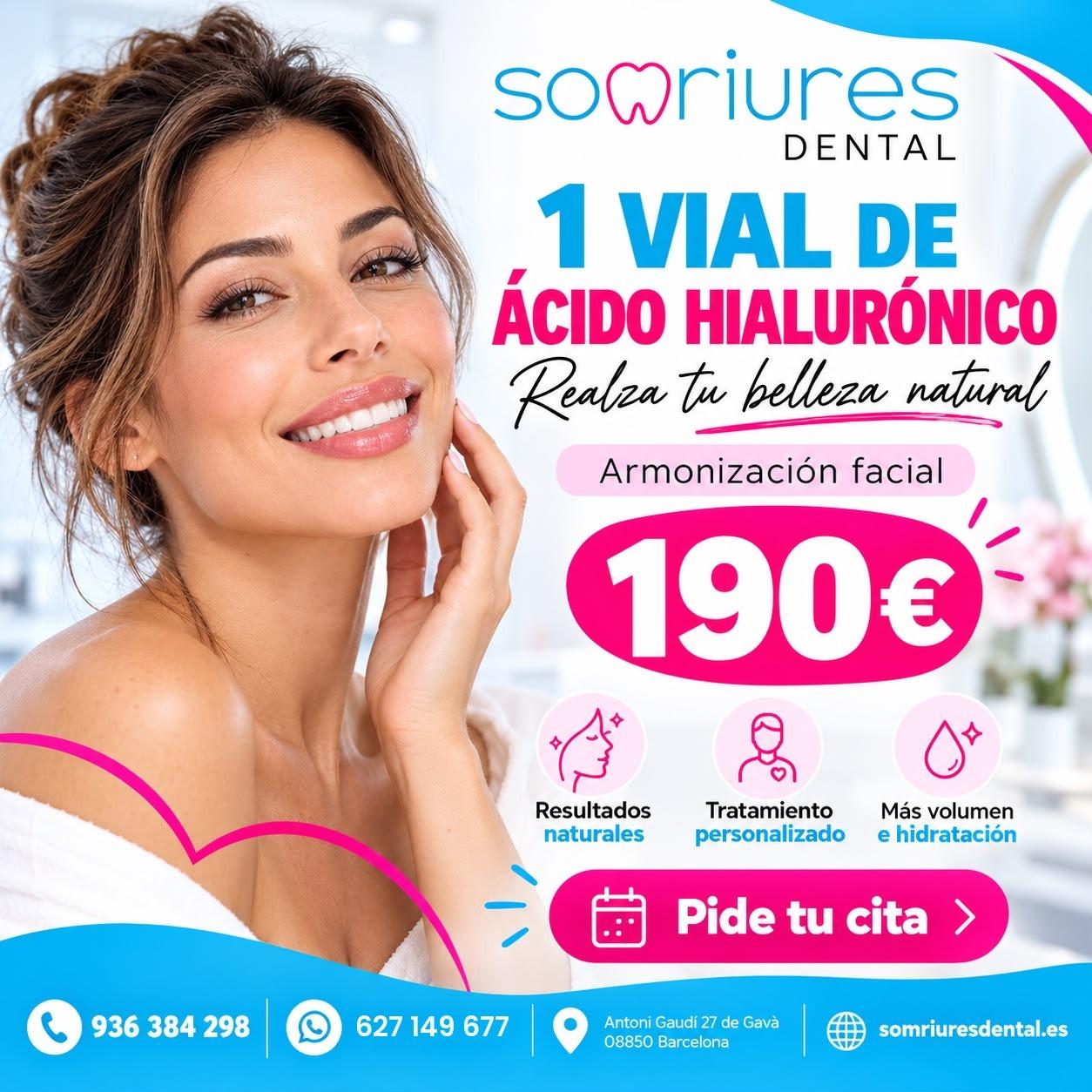 Armonización facial: 1 vial de ácido hialurónico por 190€