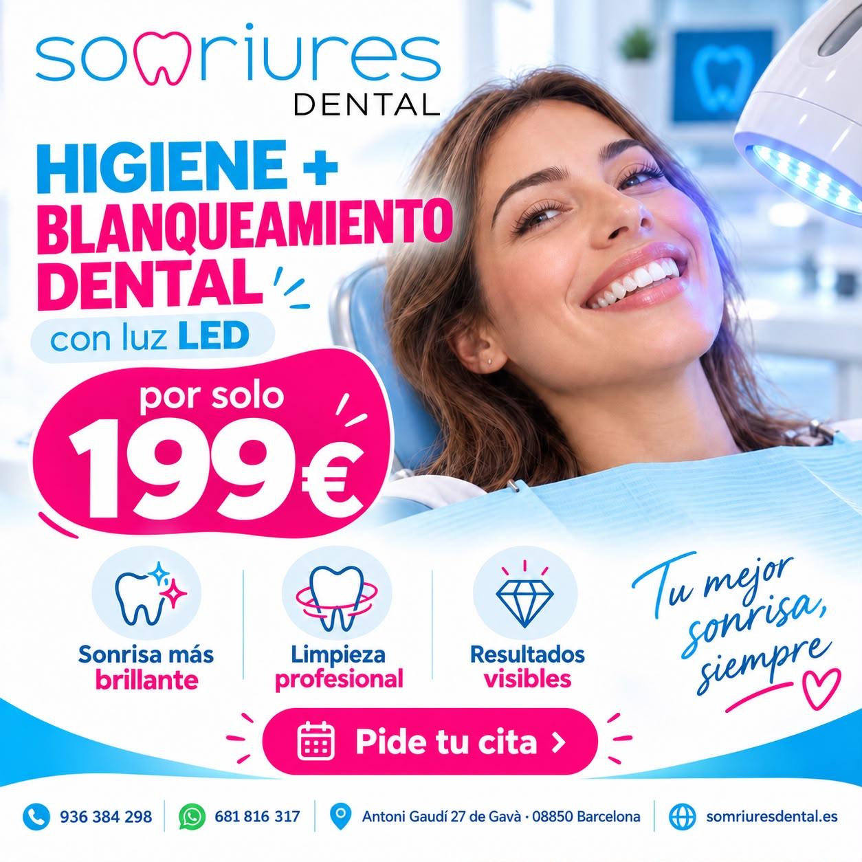 Higiene + blanqueamiento LED por 199€