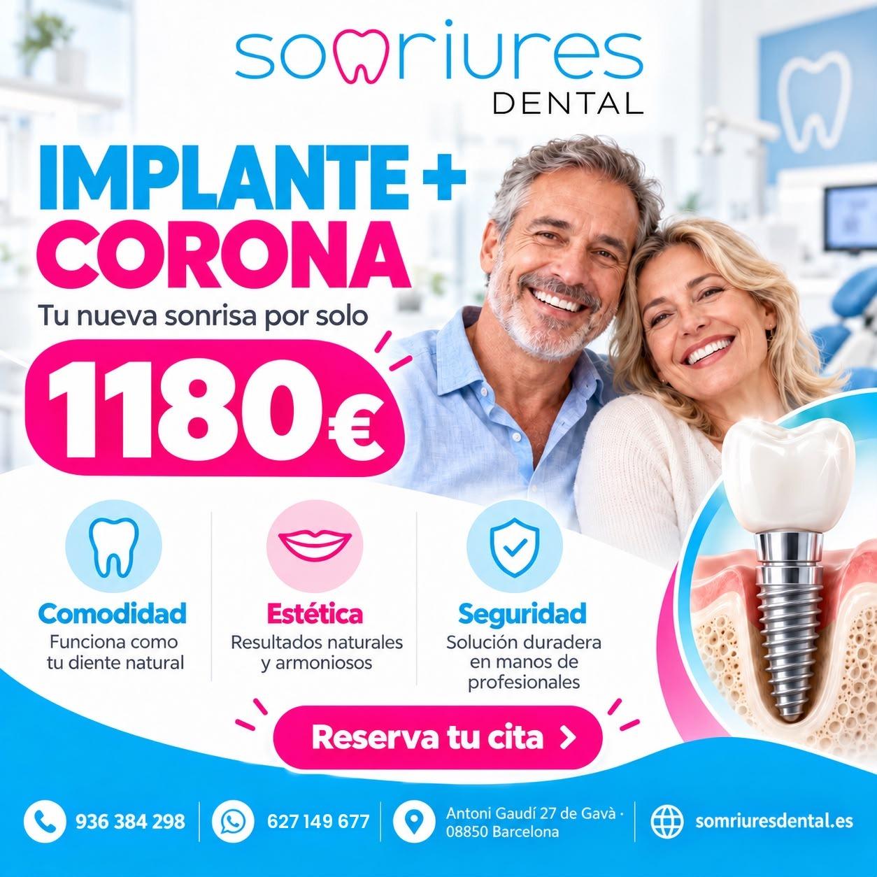 Implante dental + corona por 1.180€